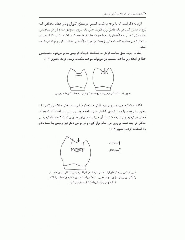 مهندسی تراش در دندانپزشکی ترمیمی