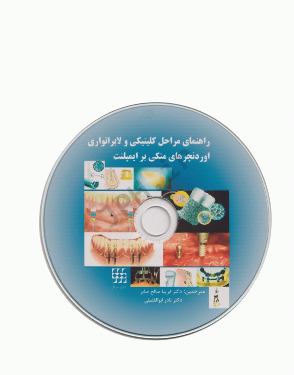 راهنمای مراحل کلینیکی و لابراتواری اوردنچرهای متکی بر ایمپلنت همراه با CD
