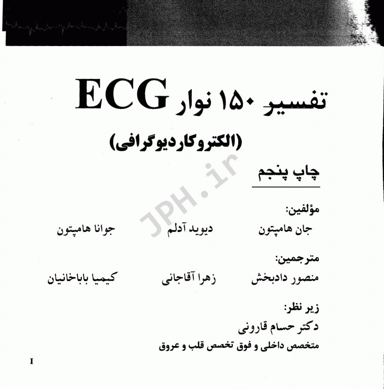 تفسیر 150 نوار ECG الکتروکاردیوگرافی 2019