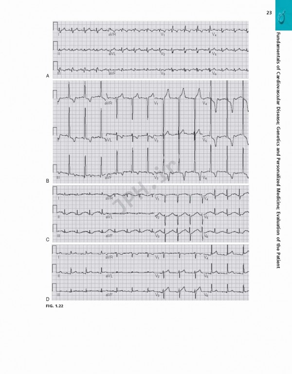 بررسی و ارزیابی بیماری قلبی براونوالد ویراست یازدهم | Braunwald's Heart Disease Review and Assessment 2019