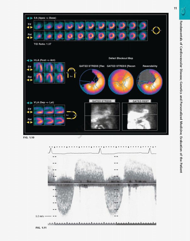بررسی و ارزیابی بیماری قلبی براونوالد ویراست یازدهم | Braunwald's Heart Disease Review and Assessment 2019