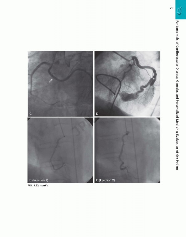 بررسی و ارزیابی بیماری قلبی براونوالد ویراست یازدهم | Braunwald's Heart Disease Review and Assessment 2019