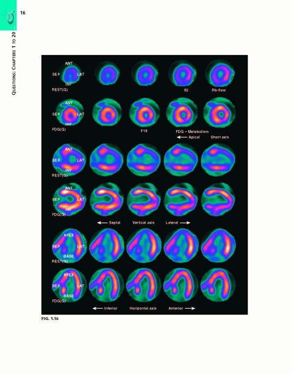 بررسی و ارزیابی بیماری قلبی براونوالد ویراست یازدهم | Braunwald's Heart Disease Review and Assessment 2019