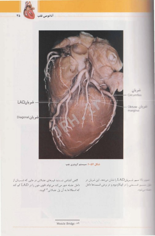 نکات کلیدی در جراحی قلب و ICU دکتر میرمحمدصادقی