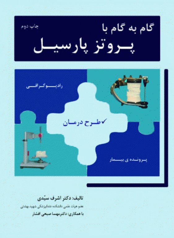 گام به گام با پروتز پارسیل