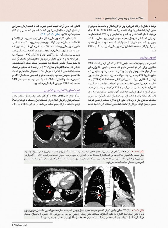 بیماری‌های ریوی کودکان کندیگ 2019 جلد5 اختلالات متفرقه‌ی ریه مدل آئرودایجستیو