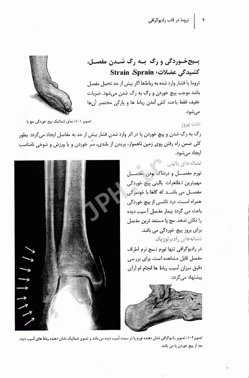 تروما در قاب رادیوگرافی