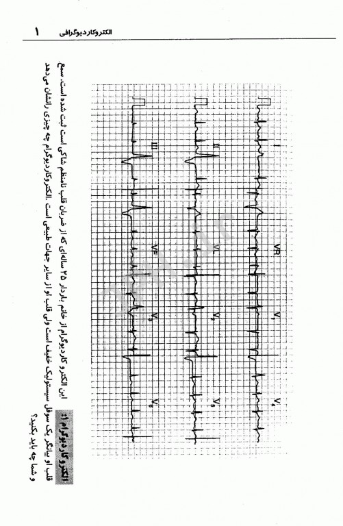 الکتروکاردیوگرافی 150 بیمار (ساده تا پیچیده) دکتر محتشمی