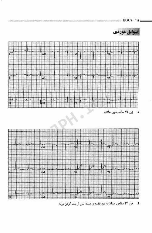 تفسیر ECGهای شایع برای پزشکان