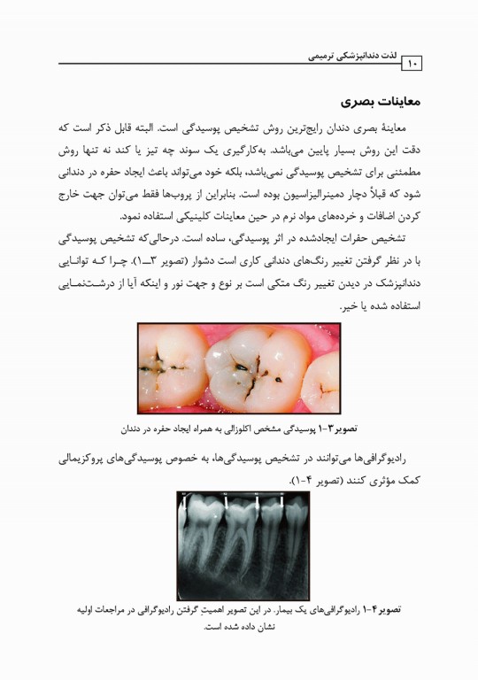 لذت دندانپزشکی ترمیمی