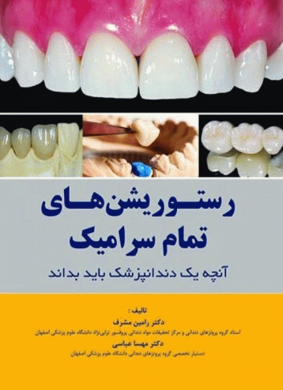 رستوریشن‌های تمام سرامیک آنچه یک دندانپزشک باید بداند
