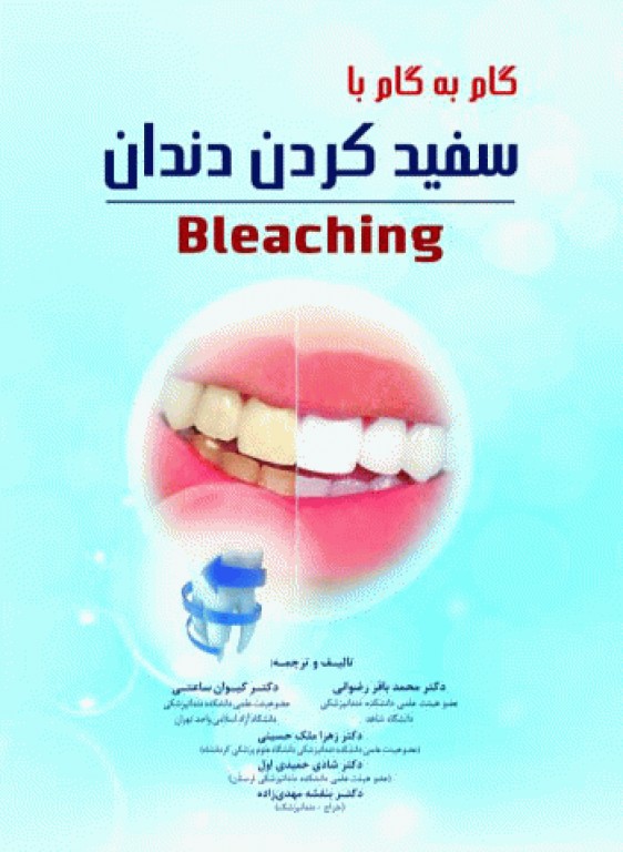 گام به گام با سفید کردن دندان Bleaching
