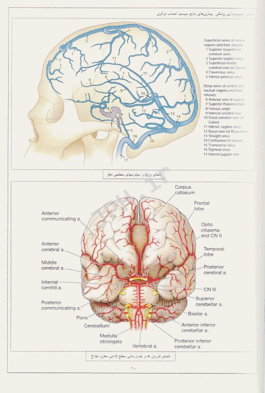 بررسی تصویربرداری پزشکی بیماری‌های شایع سیستم اعصاب مرکزی