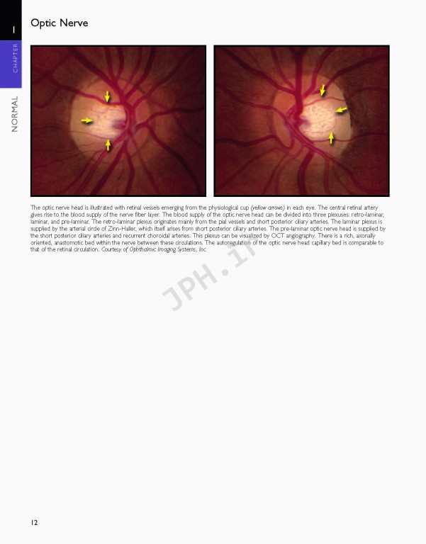 اطلس شبکیه چشم ویراست دوم | The Retinal Atlas