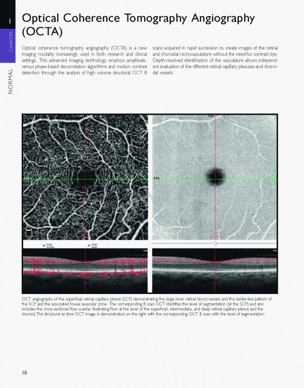 اطلس شبکیه چشم ویراست دوم | The Retinal Atlas