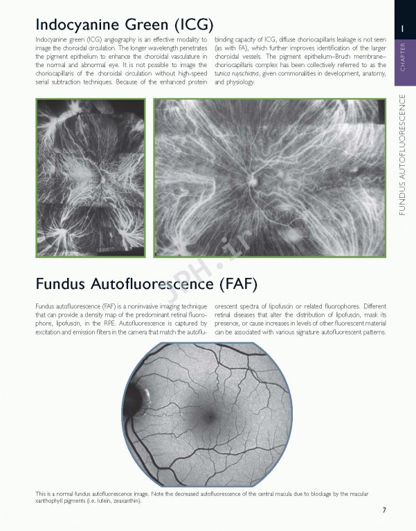 اطلس شبکیه چشم ویراست دوم | The Retinal Atlas