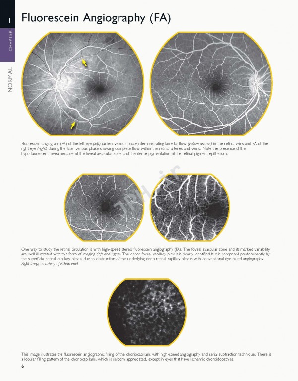 اطلس شبکیه چشم ویراست دوم | The Retinal Atlas