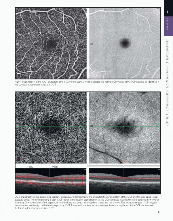 اطلس شبکیه چشم ویراست دوم | The Retinal Atlas