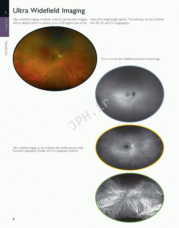 اطلس شبکیه چشم ویراست دوم | The Retinal Atlas