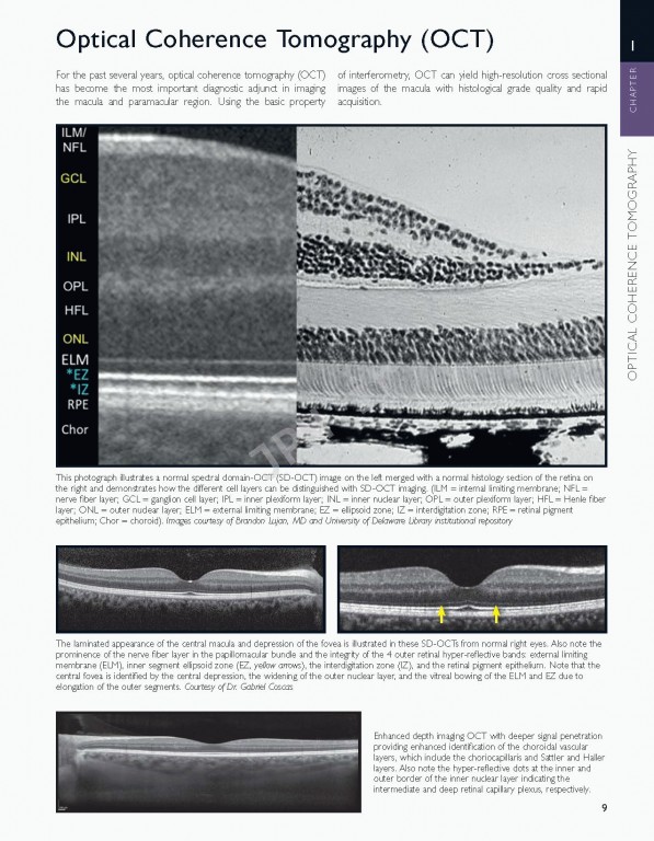 اطلس شبکیه چشم ویراست دوم | The Retinal Atlas