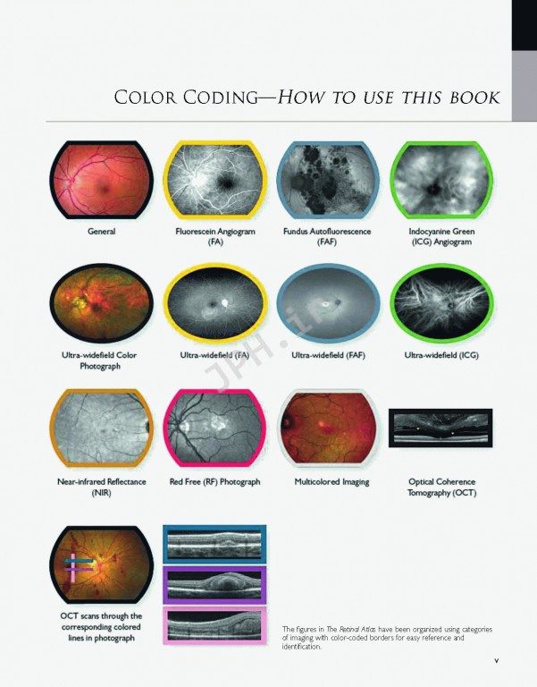 اطلس شبکیه چشم ویراست دوم | The Retinal Atlas