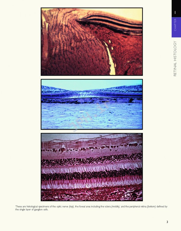 اطلس شبکیه چشم ویراست دوم | The Retinal Atlas