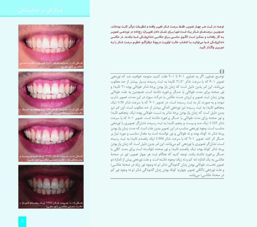 فتوگرافی در دندانپزشکی دکتر وحید کریمی