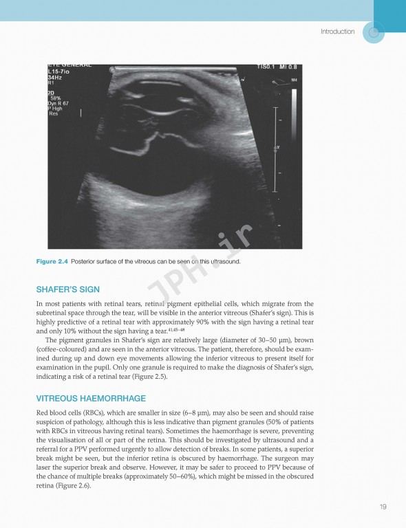 اختلالات زجاجیه شبکیه در مراقبت‌های اولیه | Vitreoretinal Disorders in Primary Care