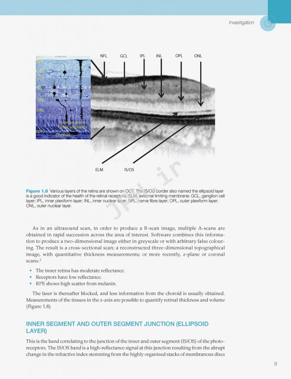 اختلالات زجاجیه شبکیه در مراقبت‌های اولیه | Vitreoretinal Disorders in Primary Care