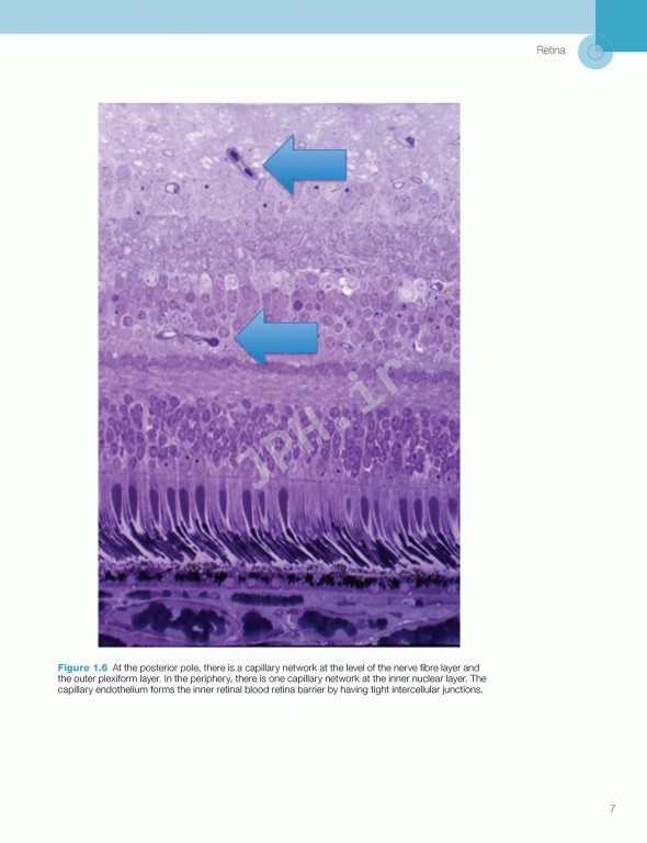 اختلالات زجاجیه شبکیه در مراقبت‌های اولیه | Vitreoretinal Disorders in Primary Care