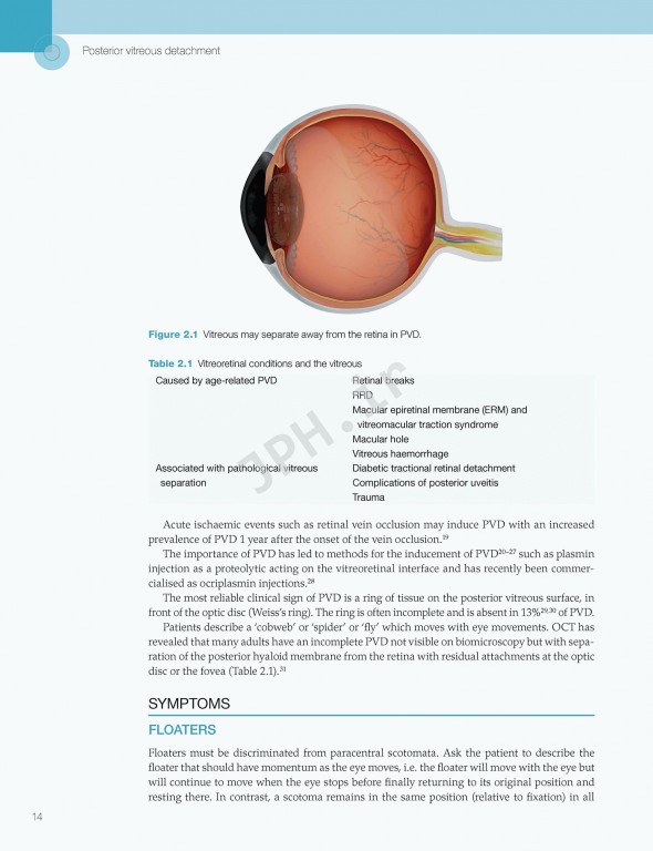 اختلالات زجاجیه شبکیه در مراقبت‌های اولیه | Vitreoretinal Disorders in Primary Care