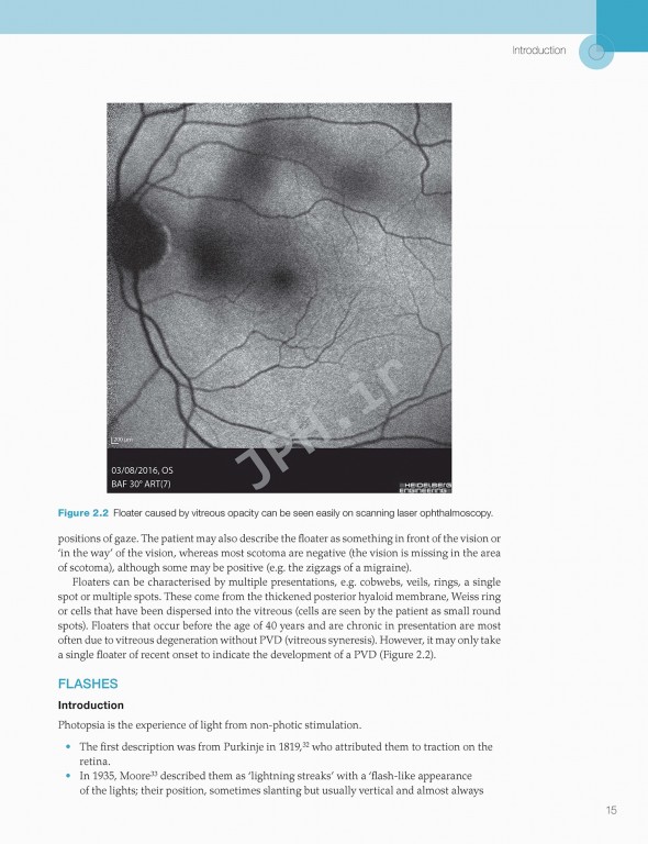 اختلالات زجاجیه شبکیه در مراقبت‌های اولیه | Vitreoretinal Disorders in Primary Care