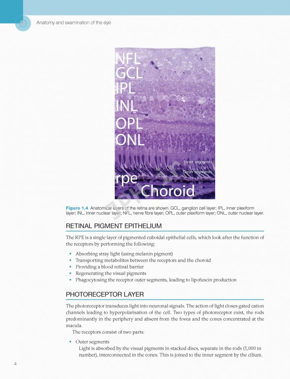 اختلالات زجاجیه شبکیه در مراقبت‌های اولیه | Vitreoretinal Disorders in Primary Care