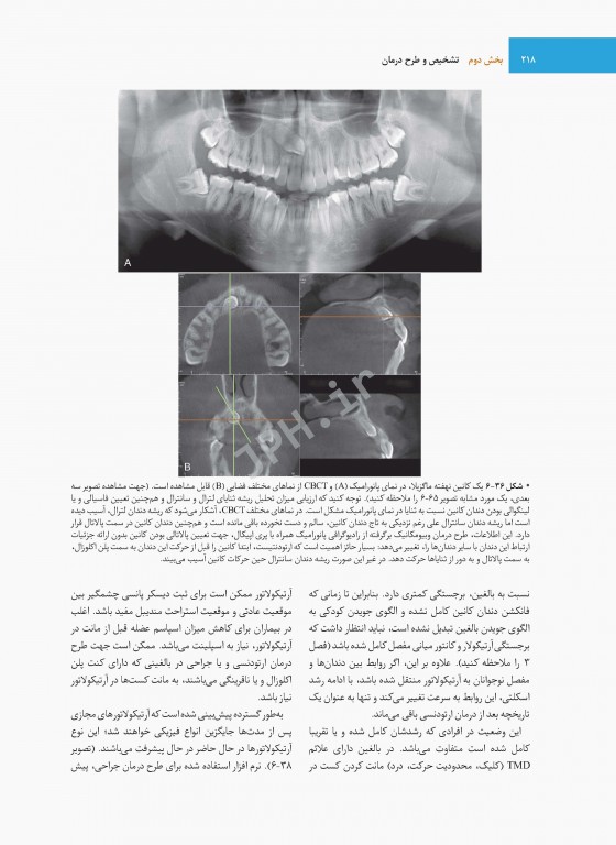 ارتودنسی نوین پروفیت 2019