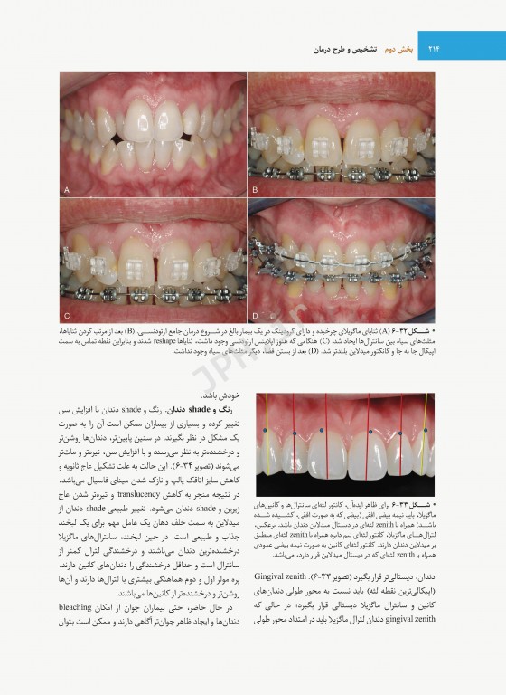 ارتودنسی نوین پروفیت 2019