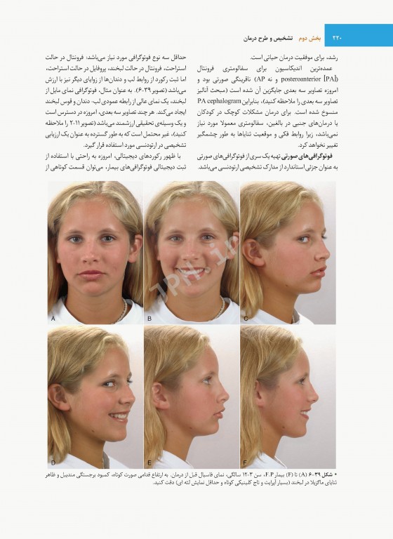 ارتودنسی نوین پروفیت 2019