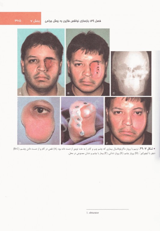 اصول جراحی دهان فک و صورت نوین پیترسون 2019 جلد دوم