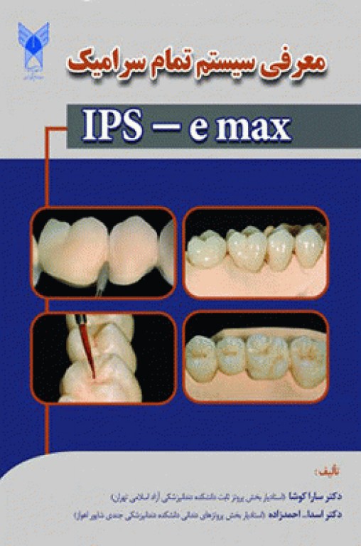معرفی سیستم تمام سرامیک IPS e‌max