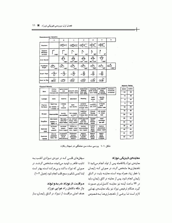 مراقبت‌های ویژه پرستاری نوزادان NICU