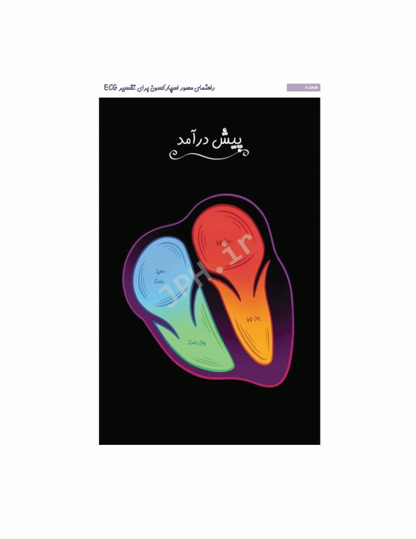 راهنمای مصور اسپارکسون برای تفسیر ECG