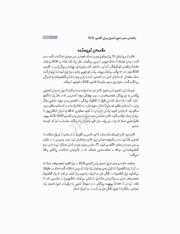 راهنمای مصور اسپارکسون برای تفسیر ECG