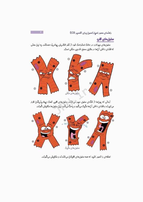 راهنمای مصور اسپارکسون برای تفسیر ECG