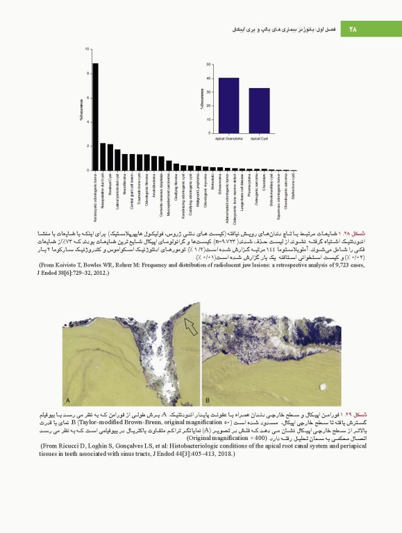 اصول و درمان اندودانتیکس ترابی‌نژاد 2021 همراه با فیلم آموزشی بصورت DVD