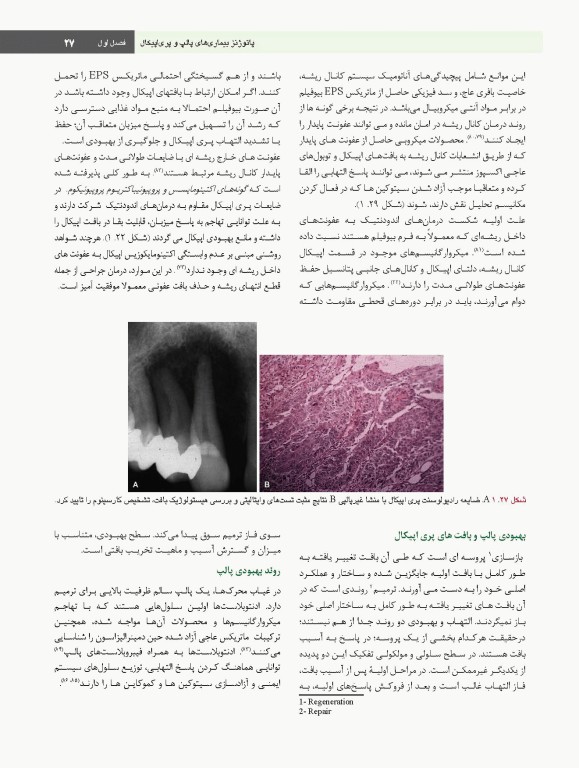 اصول و درمان اندودانتیکس ترابی‌نژاد 2021 همراه با فیلم آموزشی بصورت DVD