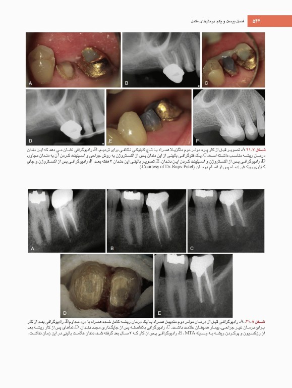 اصول و درمان اندودانتیکس ترابی‌نژاد 2021 همراه با فیلم آموزشی بصورت DVD