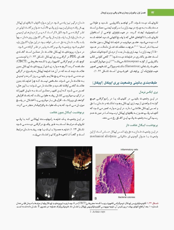 اصول و درمان اندودانتیکس ترابی‌نژاد 2021 همراه با فیلم آموزشی بصورت DVD