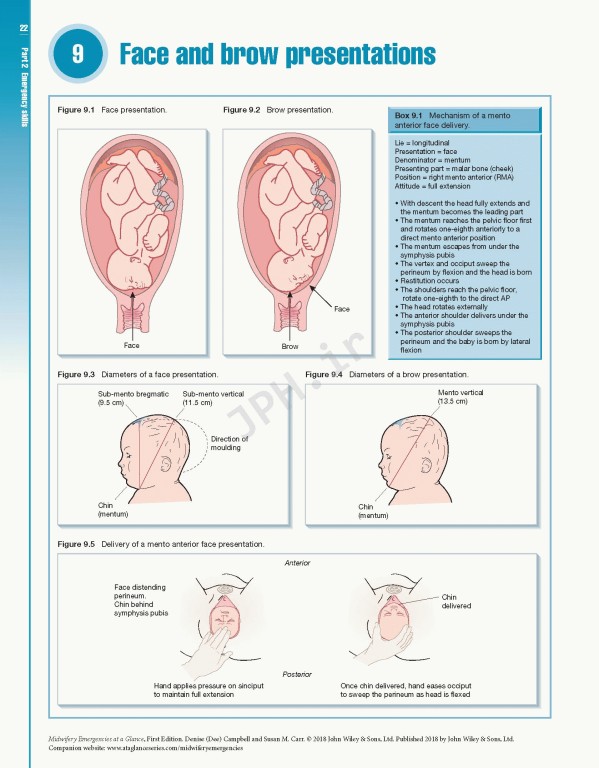اورژانس‌های مامایی در یک نگاه | Midwifery Emergencies at a Glance 2018