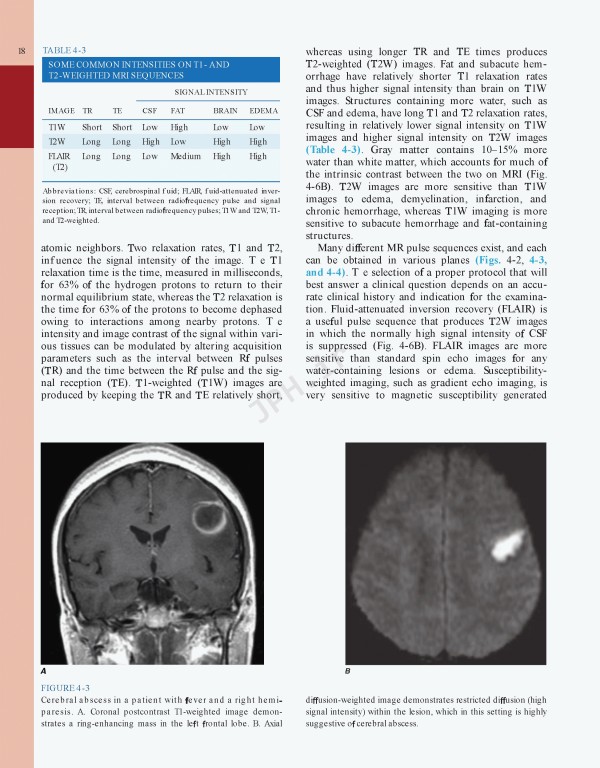 مغز و اعصاب در پزشکی بالینی هاریسون 2018 | Harrisons Neurology in Clinical Medicine 4th edition