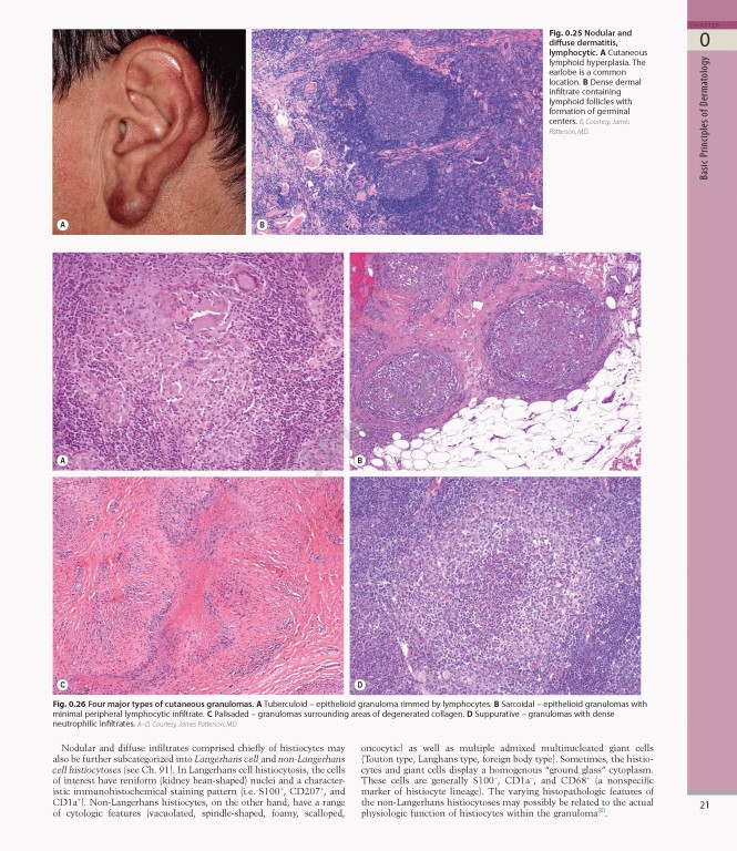 بیماری‌های پوست سه جلدی 2025 | Dermatology Bolognia 5th Edition