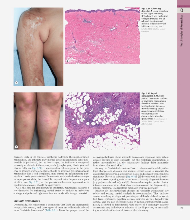بیماری‌های پوست سه جلدی 2025 | Dermatology Bolognia 5th Edition